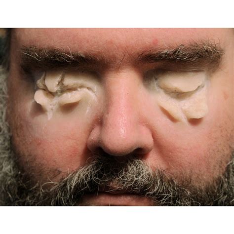 Gouged Out Eyes Prosthetics // Encapsulated Silicone // Ripped Out Eyes ...