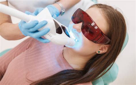 Blanqueamiento dental