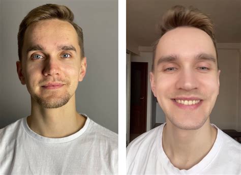 Clear Skin in 2 Weeks | Skin Optimization for Men - DAPR SKIN