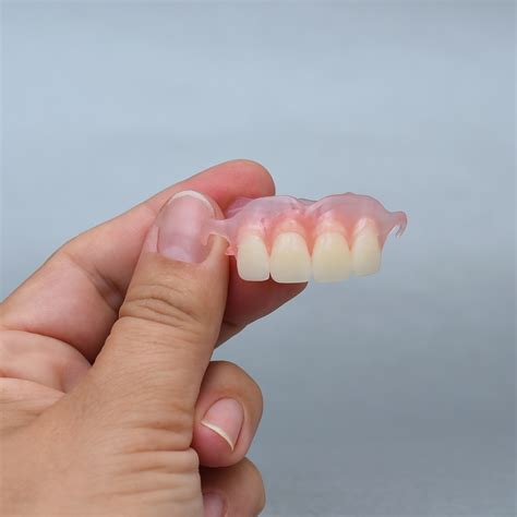 Removable Partial Denture Upper Removable Partial Dentures | Baluke