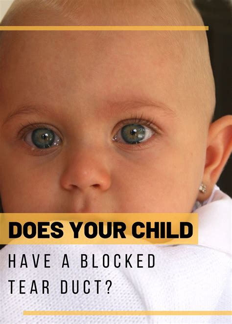 Clogged Lacrimal Duct