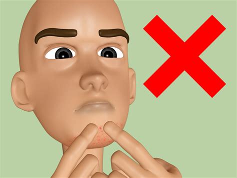 How to prevent razor bumps with pictures – Artofit