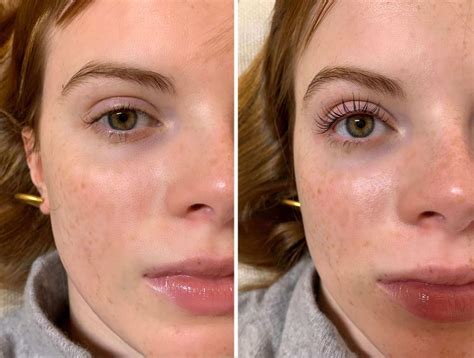What Is Lash Lift & How Long Does Lash Lift Last? In 2024