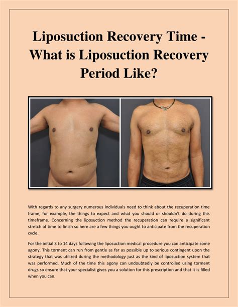 PPT - liposuction PowerPoint Presentation, free download - ID:10107019