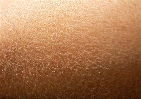 How to Get Rid of Dry Skin on Legs — Moody Sisters Skincare