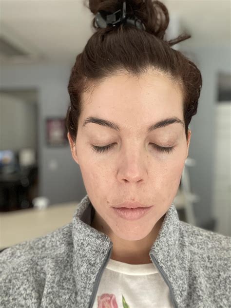 32F, more in comments. : r/30PlusSkinCare