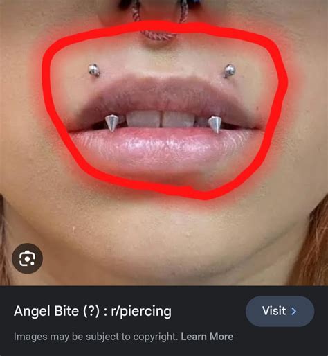 Angle bite pircings (photos to confirm) : r/PiercingAdvice
