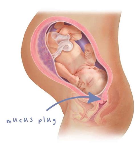 What a mucus plug looks like (with pictures) | Mum's Grapevine