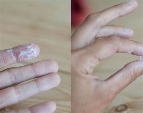 White and Creamy Discharge: Causes and Treatment - Fitness Lifetime