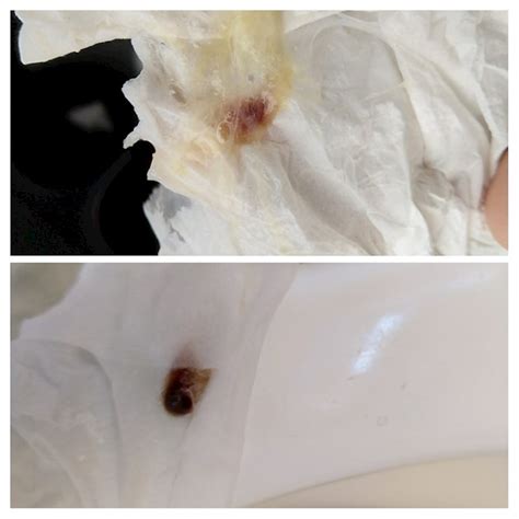 Thick Brown Mucus In Throat Every Morning at Levi Gether blog