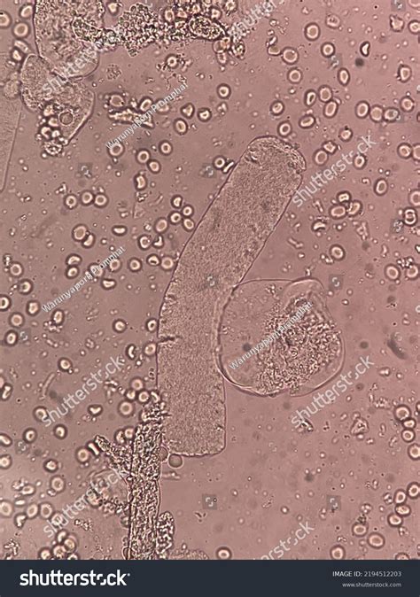 5 Board Waxy Cast Images, Stock Photos & Vectors | Shutterstock