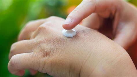12 cremas para curar cicatrices, quemaduras y heridas en todo tipo de pieles | Escaparate | EL PAÍS