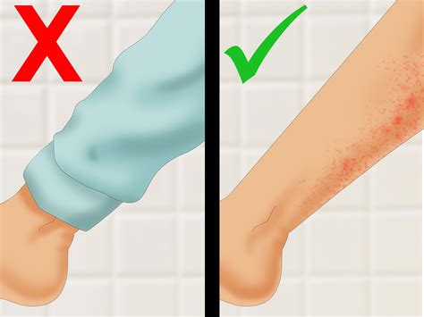4 Ways to Get Rid of Razor Burn Fast - wikiHow | Razor burns, Razor burn treatment, Razor bumps ...