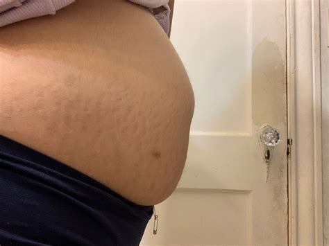 Swollen/bloated upper abdomen | BabyCenter