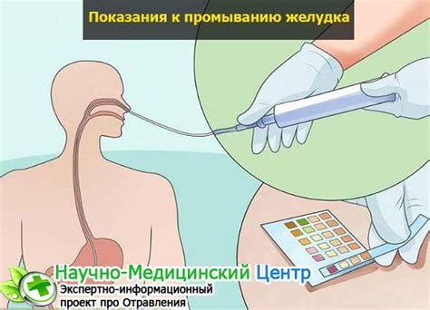 Как промыть желудок в домашних условиях: инструкция и методы