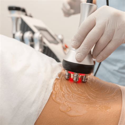 Radio Frequency Treatment