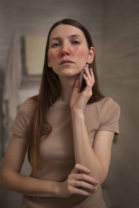 How to Reduce Swelling of Face after Rhinoplasty?