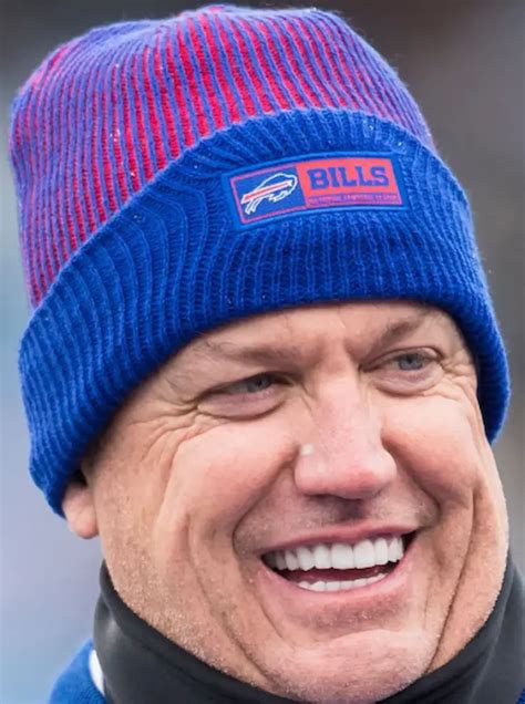 🏈 Rex Ryan Teeth (Old/New): Before and Afters | LEMA