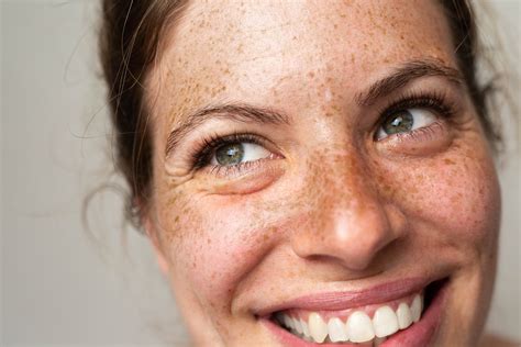 If you or your children have freckles, here's what your skin is trying ...