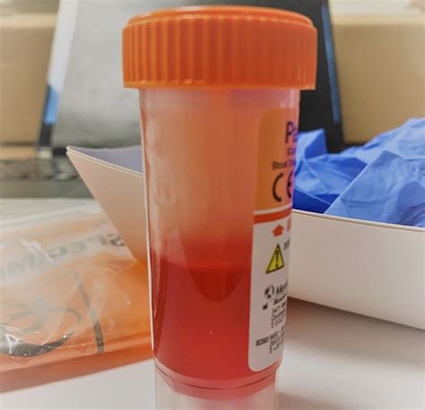 H. Pylori Test | A Comprehensive At-Home Stool Test for Helicobacter pylori, Virulence Factors ...