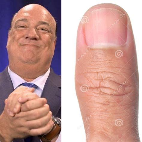 Why does it when I look at Paul Hayman he looks like a thumb is it just me or does he look like ...