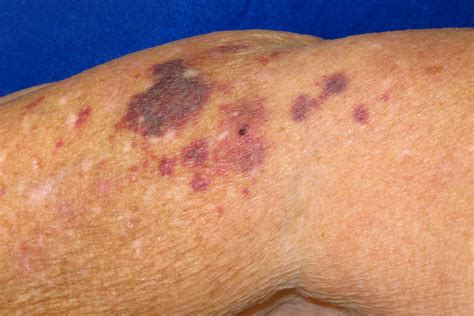 19 Possible Causes of Concerning Red Spots