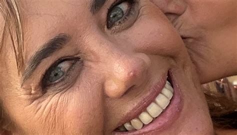 My 'pimple' turned out to be cancer — the warning signs I ignored