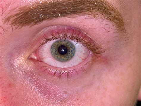 Not sure what color to consider my eyes? : r/eyes