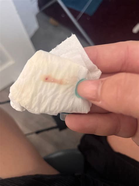 What Does Implantation Bleeding Look Like Pictures