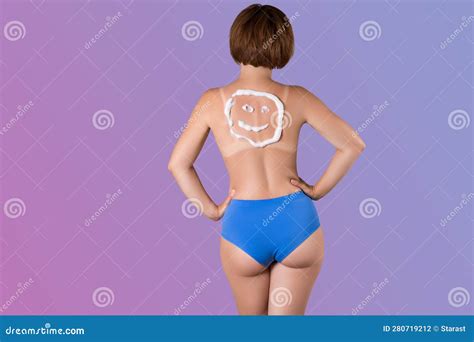 Sunburned Woman, Sunburn Marks on the Body, Smiley Sunscreen on the ...