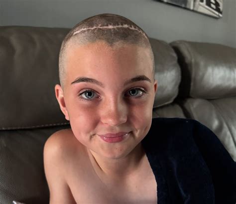 Kirkcaldy family hope second brain op will end Myla Ray's seizures