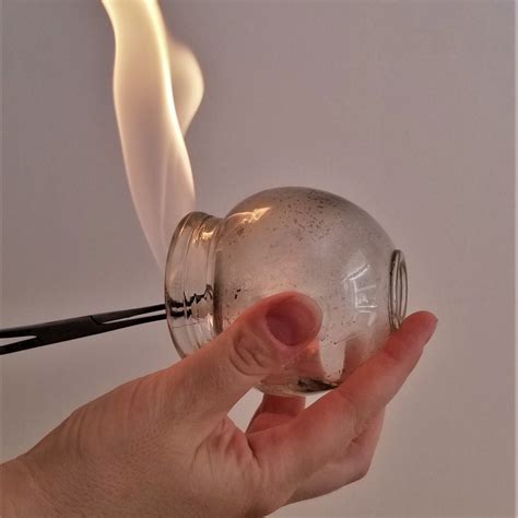 Chinese Cupping Fire at James Kates blog