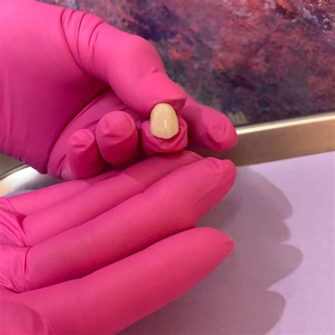 Dental Veneers in New Lenox, IL | Lincolnway Dental Associates