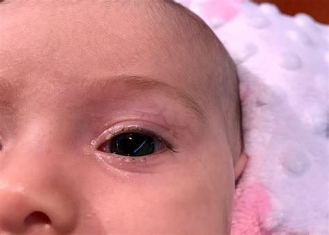 Bouncing Eyes In Babies at Eugene Eric blog