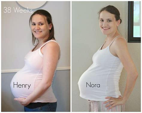 Fetus At 38 Weeks Pregnancy