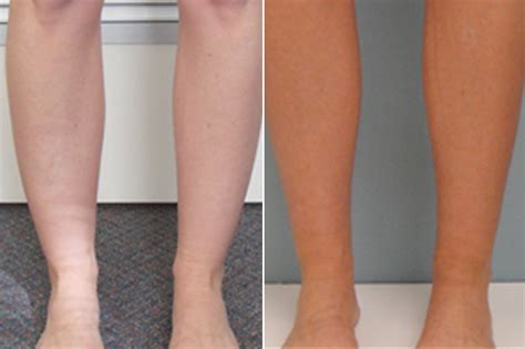 What To Wear If You Have Cankles at Jason Steck blog