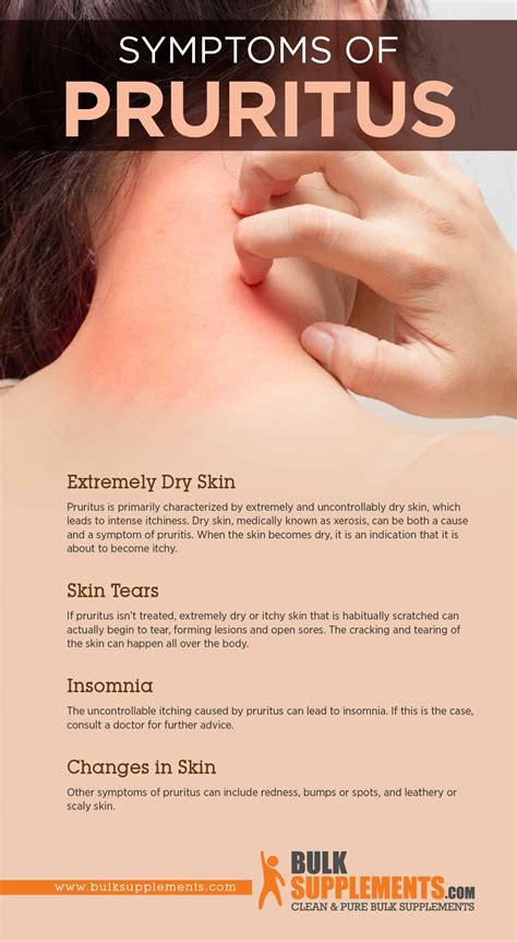 Causes And Treatment Of Pruritus Itchy Skin Uraemic Pruritus (Renal
