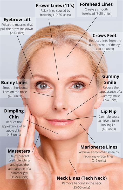 Botox Injections in Salt Lake City | Botulinum Toxin | Botox injections, Botox, Botox fillers