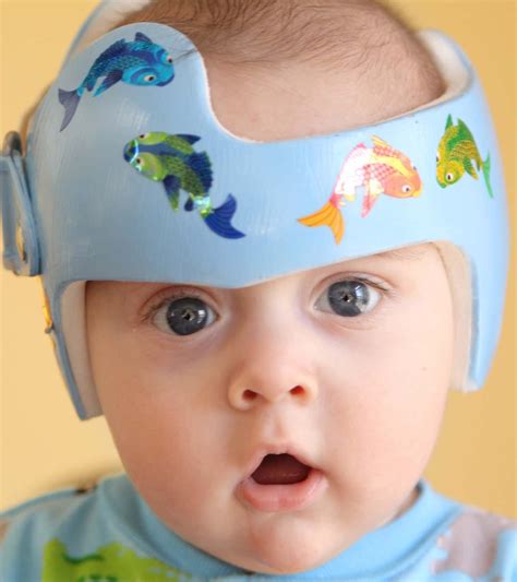 Why Do Babies Have To Wear Helmets | Renew Physical Therapy