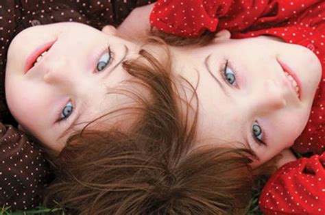 Conoce a Krista y Tatiana Hogan, las siamesas que comparten cerebro y ...
