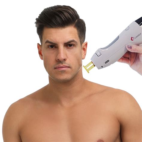 Is Laser Good For Chin Hair Removal at Allyson Byerly blog