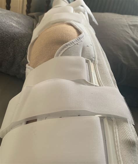 Just had acl surgery and meniscus repair, let the road to recovery begin! Feel free to leave any ...