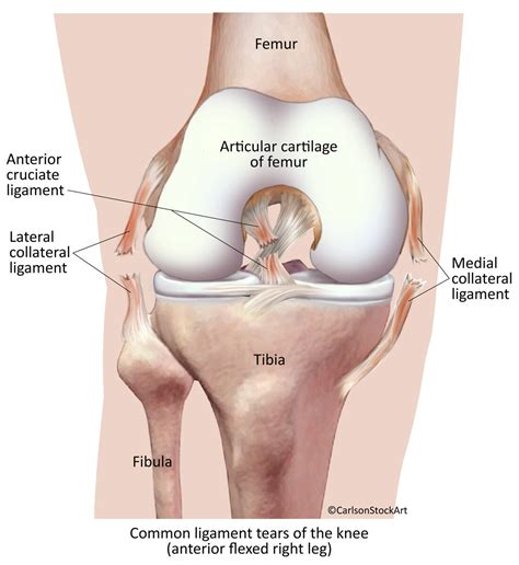 Torn Ligaments of the Human Knee - Anterior View | Carlson Stock Art