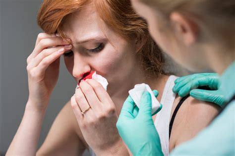 What Are the Main Causes of Nosebleeds? - My Best Works