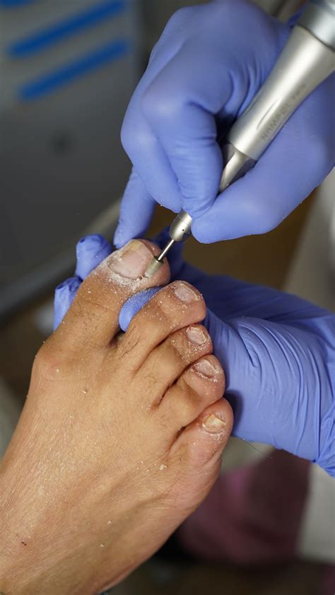 Medi Pedi NYC | Safe & Painless Foot Care (@medipedinyc) • Instagram ...