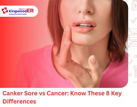Canker Sore Vs Cancer: Know These 8 Key Differences