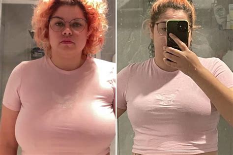 Breast Reduction Before And After In Clothes