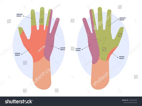 60 Elbow Ulnar Ligaments Images, Stock Photos & Vectors | Shutterstock