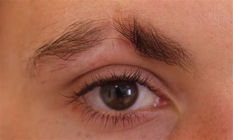 Medical tattooing for Scar in Eyebrow (male) - Rae Denman