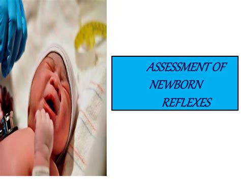 ASSESSMENT OF NEWBORN REFLEXES | PPTX